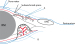 This Image - Fig. 1: Meningeal infiltration