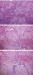 Abb. 2a-c: Transplantatabstoung