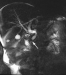 Abb. 1: MRCP