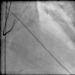 Abb. 11: Film 7