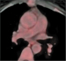 Abb. 4: PET-CT