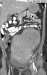 Aktuelles Bild - Abb. 1: Vense Thromboembolie