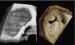 Fig. 1: 3D-Echokardiographie