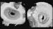 Fig. 3: 3D-Echokardiographie