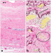 Abb. 5a-b: Histologisches Prparat