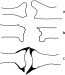 Abb. 2a-c: Gelenkssituation