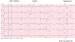 Aktuelles Bild - Abb. 4: EKG