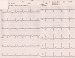 Aktuelles Bild - Abb. 1: 12-Kanal-EKG