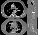 Abb. 2: Aorta