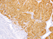 Abb. 9: Tumor