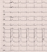 Aktuelles Bild - Abb. 3: EKG