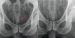 Abb. 1: Seed-Verlust