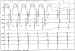 Abb. 4: EKG