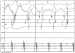 Abb. 5: EKG