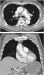 Abb. 3: CT-Angiographie
