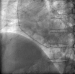 Abb. 5: Film
