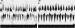 Fig. 3: Echokardiographie - Linksatriale Thromben