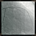 Abb. 2: Angiographie