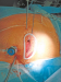 Abb. 2: Mitralklappenchirurgie