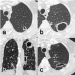 Abb. 2a-c: Nocardia abscessus