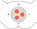 Abb. 2: Befundlokalisation