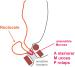 Abb. 4: Anteriorer Mukosaprolaps