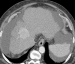 Aktuelles Bild - Abb. 1a: MDCT
