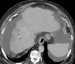 Abb. 1b: CT