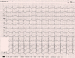 Aktuelles Bild - Abb. 1: EKG - Aufnahme