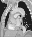Abb. 9: CT-Angiographie