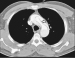 Abb. 10: CT-Angiographie