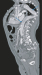 Abb. 2: CT