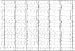 Abb. 5: EKG