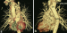 Abb. 1a-b: CT-Angiographie