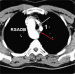 Abb. 2: CT-Angiographie