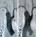 Abb. 4: Angiographie - Aorta