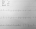 Aktuelles Bild - Abb. 1: EKG