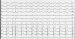 Abb. 2: EKG