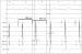 Abb. 3: EKG