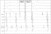 Abb. 5: EKG 