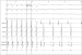 Aktuelles Bild - Abb. 6: EKG