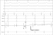Abb. 7: EKG