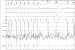Abb. 9: EKG