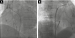 Aktuelles Bild - Abb. 1a-b: Echo