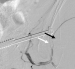 Abb. 5: Thrombininjektion