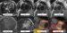 Abb. 7: PET-MRT