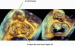Abb. 3: 3D-TEE surgical view