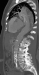 Abb. 1: Produkt: Stentgraft<br>
Vertrieb: Jotec GmbH