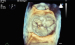 Abb. 3: Surgical view