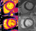 Aktuelles Bild - Abb. 4: HFpEF